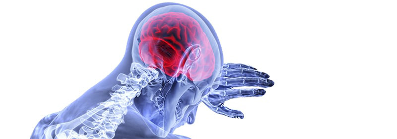 xray of a human showcasing the brain